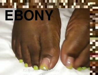 IG foot model @empressdani8590 cummy yellow toes