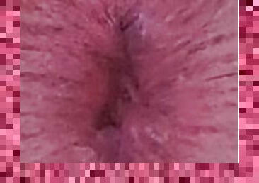 My winking ass hole